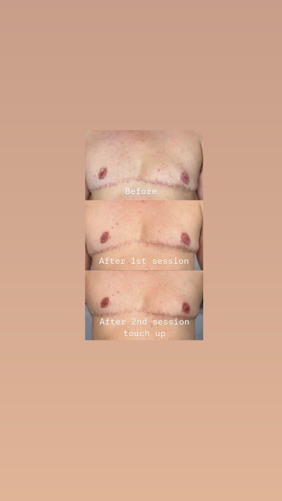 Listing cover image